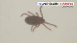 マダニが媒介「日本紅斑熱」今年初めて感染確認　熊本　|　熊本のニュース｜RKK NEWS｜RKK熊本放送