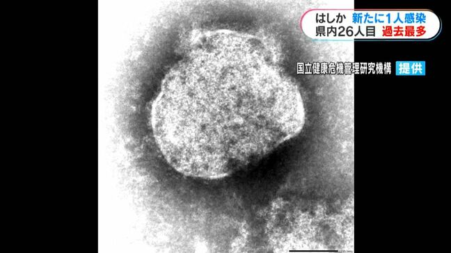 はしか新たに1人感染 10代男性 県内26人目 統計開始以降、過去最多 鹿児島|TBS NEWS DIG