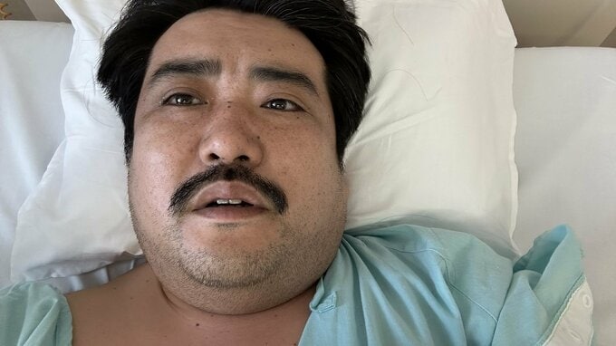 【空気階段・鈴木もぐら】人工股関節手術終了を報告「生してるぜ。みんな、ありがとな。」|TBS NEWS DIG