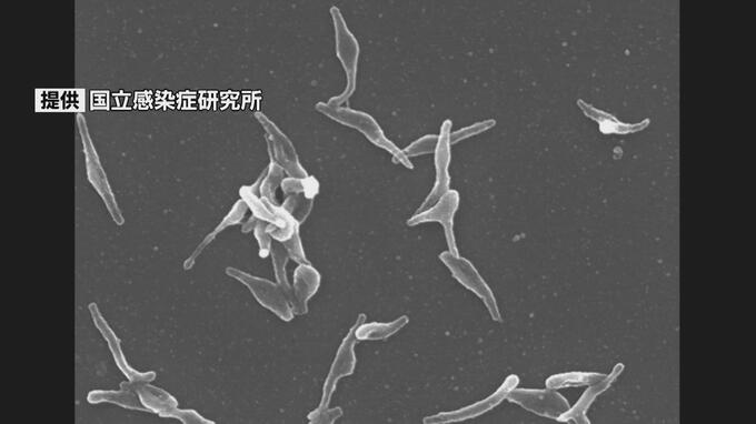 「マイコプラズマ肺炎」患者が増加・過去25年で最多に　5歳～9歳が4割占める　|　長崎のニュース | 天気 | NBC長崎放送