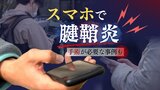 スマホの使いすぎによる腱鞘炎に注意…親指の付け根を痛める“ドュケルバン腱鞘炎”は外科手術が必要なケースも　|　福岡のニュース｜RKB NEWS｜RKB毎日放送