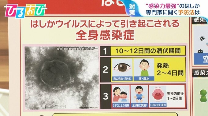 「発症前でも人に感染させる力がある」 感染相次ぐ『はしか』症状と注意点を専門家に聞く【ひるおび】|TBS NEWS DIG