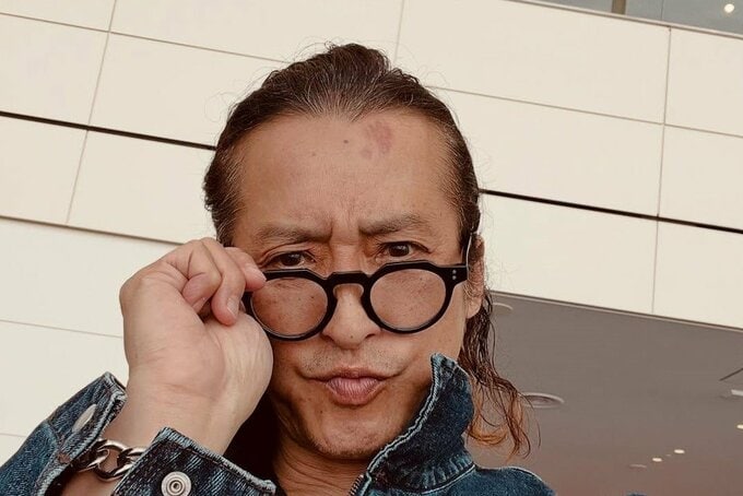 【 大沢樹生 】　「人生初の交通事故に遭った」　その１週間後には自転車で「デコから突っ込んでコケた」　額には痛々しい傷|TBS NEWS DIG