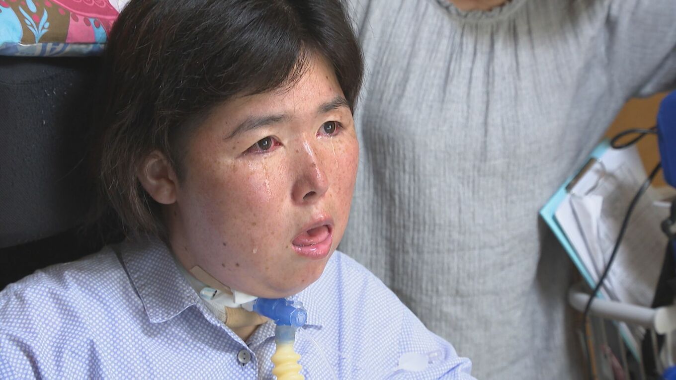 進行性難病筋ジストロフィーの女性 決意の妊娠出産「娘の結婚式に…それが今の夢」 TBS NEWS DIG (2ページ)