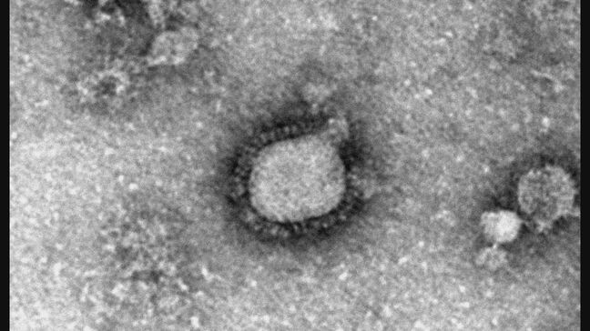 愛知で｢インフルエンザ警報｣ 過去10年間で2番目の早さ ワクチン接種しても抗体ができるまで2週間ほど…マスク着用に手洗いなど感染対策の徹底を|TBS NEWS DIG