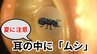 そんなの”アリ!?  ”激痛と騒音が襲う  耳の中に「ムシ」!!   昆虫が活発な夏の時期、就寝中に侵入するケース  「動きが素早いあのムシ」や「脚がたくさんあるムシ」も【画像注意】　|　岡山・香川のニュース | 天気 | RSK山陽放送
