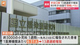 手足口病の患者数が全国で「警報レベル」&nbsp;13週連続で増加|TBS NEWS DIG