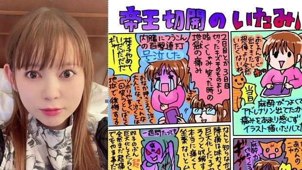 【中川翔子】「お腹痛すぎる　まだ後陣痛？が全然やばい」帝王切開出産後の痛みを絵日記で報告|TBS NEWS DIG
