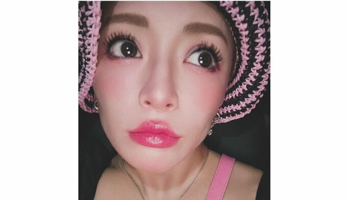 浜崎あゆみさん　「呼吸するだけで痛い」「声も出せなくなる」　自身の症状明かす　「右の鎖骨にぶっとい針刺したみたいな激痛」|TBS NEWS DIG