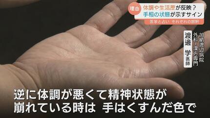 手相で病気を早期発見 年内限定14000円 手相で病気を早期発見 年内限定14000円-本物の商品