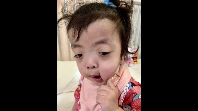 「夢唯は気付いてもらえず心肺停止に」 “異常知らせるアラーム”は鳴らない設定になっていた 医療事故で亡くなった3歳の女の子 現場に広がる深刻な“アラーム慣れ”|TBS NEWS DIG