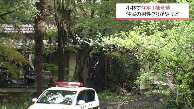 小林市で住宅1棟を全焼する火事　住人の男性がやけど|TBS NEWS DIG