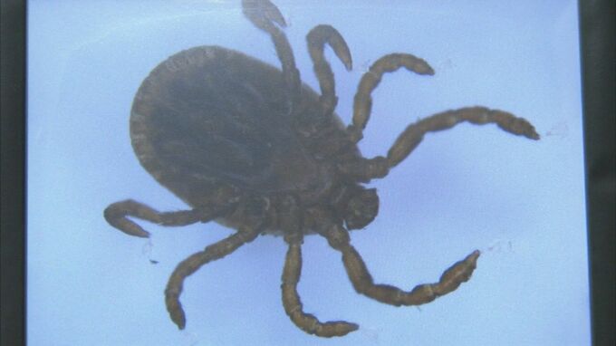 マダニにかまれることで起こる感染症「日本紅斑熱」で70代の女性が死亡【香川】　|　岡山・香川のニュース | 天気 | RSK山陽放送