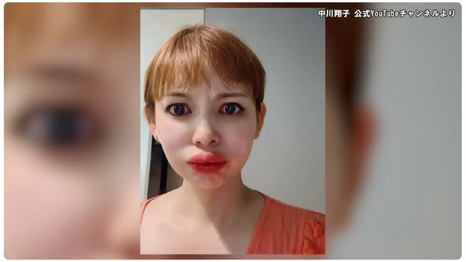 中川翔子さん 「くちびるが5倍に腫れた」 アレルギー発症の経緯を明かす 「検査やって、今、結果待ち」「まさか自分がっていう感じだった」|TBS NEWS DIG