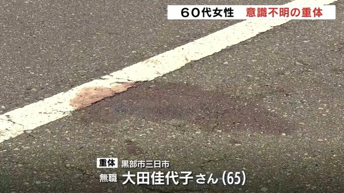 60代女性はねられ意識不明の重体　富山・黒部市の市道　横断歩道渡る女性に気づかなかったか　|　富山のニュース｜天気・防災｜チューリップテレビ