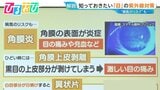 “目の日焼け”で体にシミが!?知っておきたい「目」の紫外線対策【ひるおび】|TBS NEWS DIG