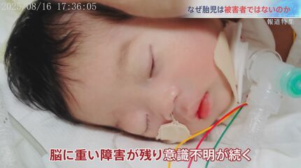 妊婦の死亡事故「胎児も被害者と認めて」赤ちゃんに重い障害が