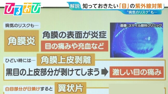 “目の日焼け”で体にシミが！？知っておきたい「目」の紫外線対策【ひるおび】|TBS NEWS DIG