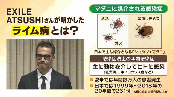 EXILE・ATSUSHIさん感染「ライム病」どんな病気？マダニ媒介の「感染症」無症状期間→発疹・筋肉痛→脳などに障がい死亡も『ダニは噛まれたらすぐに落ちない』感染症の専門家が解説|TBS NEWS DIG
