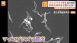 主な症状は発熱や長引く咳…マイコプラズマ肺炎が流行 1医療機関あたり2.80人と統計開始以降最多に|TBS NEWS DIG