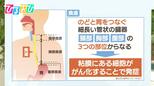 早期発見が“難しい”「食道がん」自覚症状や発見の機会は?【ひるおび】|TBS NEWS DIG