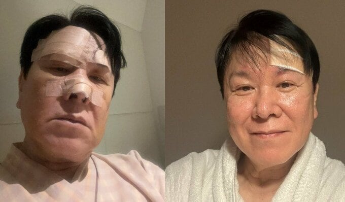 【 三ツ矢雄二 】転倒・鼻を骨折から1か月　CT検査の結果〝頭の中の出血は消えて〟〝ジンジンが無くなるまで安静に〟　「心はとても元気で健やか」笑顔で投稿|TBS NEWS DIG