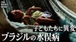 “ブラジルの水俣病”と呼ばれる健康被害  ～南米アマゾン　先住民の子どもたちに異変|TBS NEWS DIG