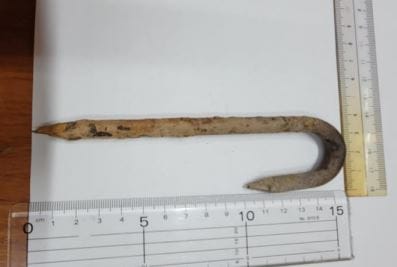 グラウンドに埋められていたピンが原因　スライディングした小学生が右膝に大けが　バッターボックス作るための目印でいつ誰が埋めたかは不明　長野・小布施町|TBS NEWS DIG