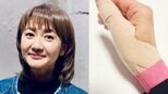 【がん闘病】古村比呂さん 「身体が重だるくゴロゴロしています」　「腱鞘炎」診断の右手は「負担がかからないよう　左手でやれることはやるように心がけて動くと　倍の時間がかかります」|TBS NEWS DIG