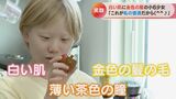 「アルビノも悪くない」2万人に1人の “指定難病” を患う12歳少女 新たなチャレンジに密着|TBS NEWS DIG