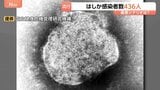 今年のはしか感染者数436人に 去年の約4.5倍のペースで拡大 感染のピークは4月中旬から6月下旬と推定 最悪の場合1年間で1600人超に達する可能性も|TBS NEWS DIG