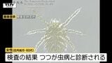 庄内地方に住む60代女性がつつが虫病に感染 県内では今年初(山形) | 山形のニュース│TUYテレビユー山形