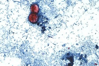 重い下痢引き起こす寄生虫由来の感染症、米ミシガン州で患者2600人超| TBS CROSS DIG with Bloomberg