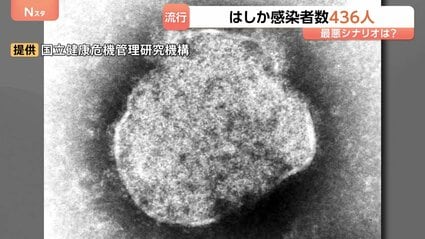 今年のはしか感染者数436人に 去年の約4.5倍のペースで拡大 感染の