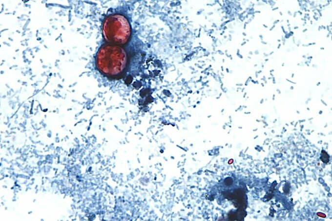 重い下痢引き起こす寄生虫由来の感染症、米ミシガン州で患者2600人超