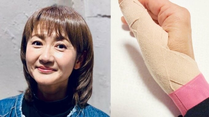 【がん闘病】古村比呂さん 「身体が重だるくゴロゴロしています」　「腱鞘炎」診断の右手は「負担がかからないよう　左手でやれることはやるように心がけて動くと　倍の時間がかかります」|TBS NEWS DIG