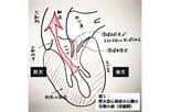 遺伝的要因も…心臓の筋肉が分厚くなる「肥大型心筋症」と「僧帽弁閉鎖不全症」~『ブラックペアン』監修ドクターが解説 vol.12~|TBS NEWS DIG
