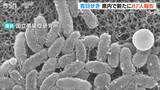 『百日咳』3か月で去年1年間を上回る感染者 20歳未満が9割以上 新潟県|TBS NEWS DIG