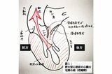 遺伝的要因も…心臓の筋肉が分厚くなる「肥大型心筋症」と「僧帽弁閉鎖不全症」～『ブラックペアン』監修ドクターが解説 vol.12～|TBS NEWS DIG