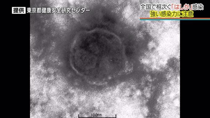沖縄でことし2例目のはしか感染を確認　26日に航空機→那覇空港→タクシー利用　現在は体調回復傾向|TBS NEWS DIG