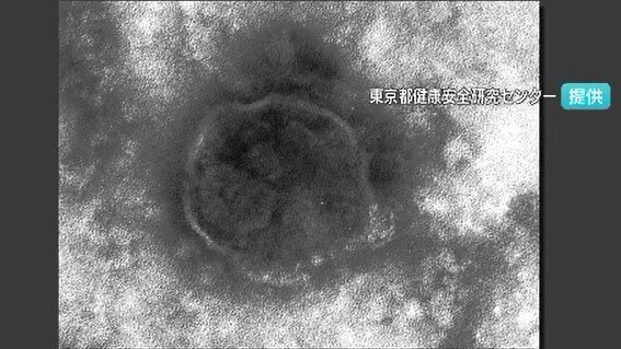 【はしか】感染患者が長野市内の施設や列車利用…JR長野駅ビル内のコーヒー店・長野電鉄の特急「スノーモンキー」北陸新幹線も利用…市が注意呼びかけ　|　SBC NEWS | 長野のニュース | SBC信越放送