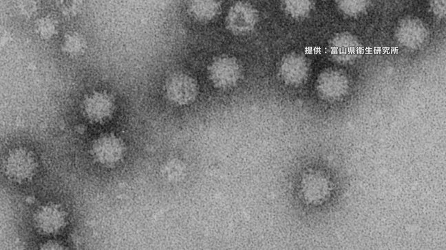 介護施設でノロウイルスによる集団食中毒…男性1人死亡　施設内で調理された昼食が原因か　富山市|TBS NEWS DIG