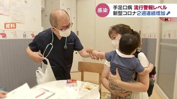 夏場に乳幼児がかかりやすい『手足口病』…富山で5週連続で「流行警報レベル」新型コロナウイルスも感染が拡大　|　富山のニュース｜天気・防災｜チューリップテレビ