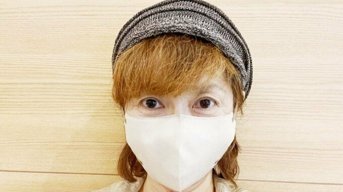 【 がん闘病 】古村比呂さん　抗がん剤治療の延期を報告　「頭皮の帯状疱疹がまだ治っていない為」「このまま投与すると再び免疫が落ちて体調が悪くなる可能性が大きい」|TBS NEWS DIG