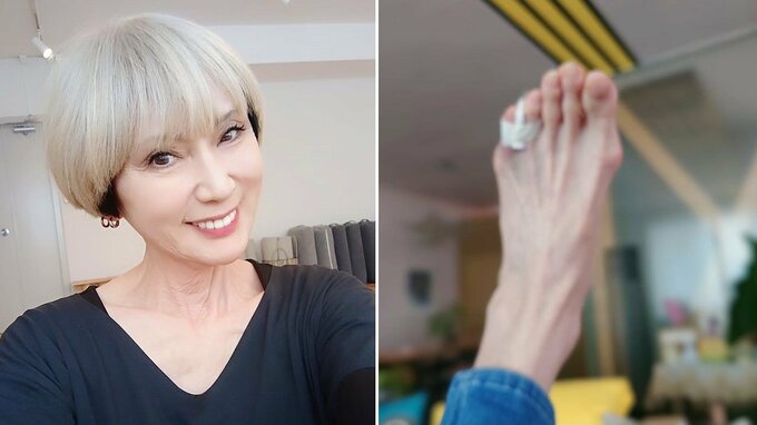 【 秋野暢子 】　左足小指の骨折を報告　「4年ぶりの骨折です。やれやれですね。ドジな私です」「小指と何やら固い物と喧嘩　小指の惨敗です」|TBS NEWS DIG