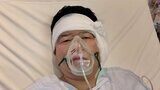 ダイアン・津田さん 手術を報告 真珠腫性中耳炎のため 「高熱が出るんですよね。それがねなかなかしんどくて」 全身麻酔で|TBS NEWS DIG