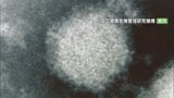 SFTS=重症熱性血小板減少症候群の患者 山梨で初の確認 予防のポイント|TBS NEWS DIG