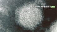 SFTS=重症熱性血小板減少症候群の患者 山梨で初の確認 予防のポイント | 山梨のニュース | UTYテレビ山梨