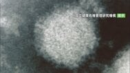 SFTS＝重症熱性血小板減少症候群の患者　山梨で初の確認　予防のポイント　|　山梨のニュース | ＵＴＹテレビ山梨