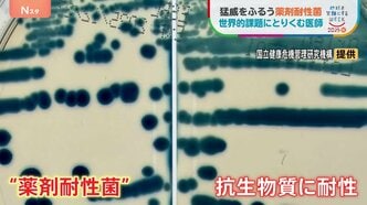 薬が効かなくなる“薬剤耐性菌”2050年には世界で年間1000万人超死亡のおそれが… 世界的課題に取り組む医師　“抗菌薬の適正使用と感染対策”|TBS NEWS DIG